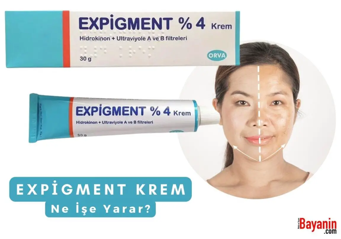 Expigment Krem Ne İşe Yarar Nasıl Kullanılır